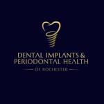 DENTAL IMPLANTS AND PERIODONTAL HEALTH profile picture