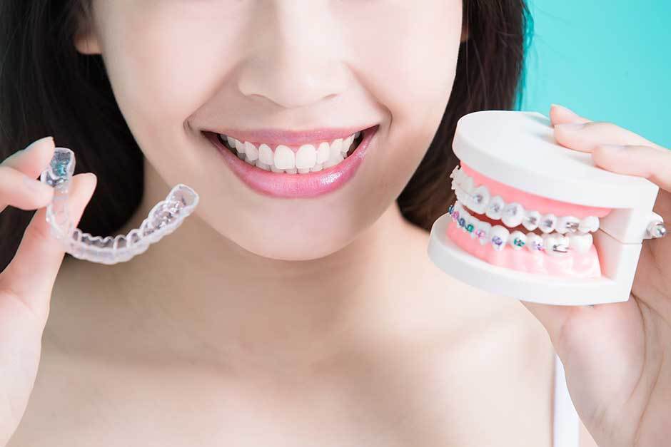 How Long Should You Wear The Retainer After Invisalign? | TheAmberPost