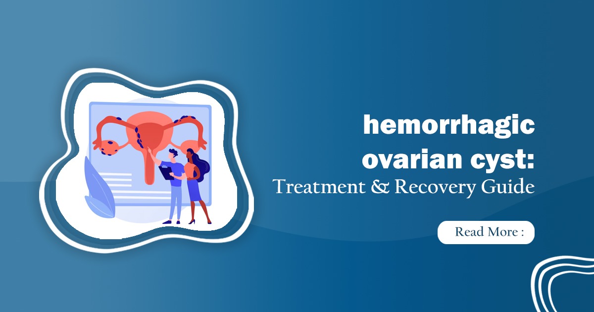 Hemorrhagic ovarian cyst - Know what is it?